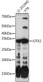 OTX2 Recombinant Rabbit Monoclonal Antibody (6I3J0)
