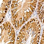 PARG Antibody in Immunohistochemistry (Paraffin) (IHC (P))