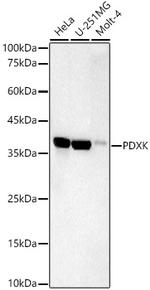 PDXK Recombinant Rabbit Monoclonal Antibody (5N4M3)