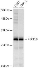 PEX11B Recombinant Rabbit Monoclonal Antibody (1U1K6)