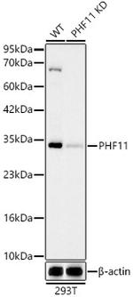 PHF11 Recombinant Rabbit Monoclonal Antibody (1J3E4)