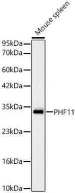 PHF11 Antibody in Western Blot (WB)