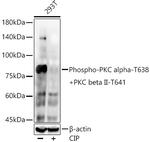 Phospho-PKC alpha/beta-2 (Thr638, Thr641) Recombinant Rabbit Monoclonal Antibody (8D8L5)