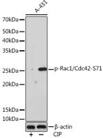 Phospho-RAC1/CDC42 (Ser71) Recombinant Rabbit Monoclonal Antibody (4X7Z2)
