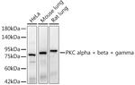 PKC alpha/beta/gamma Recombinant Rabbit Monoclonal Antibody (9O5J1)