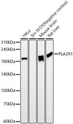 PLA2R1 Recombinant Rabbit Monoclonal Antibody (7I4Z1)