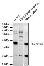 Pleckstrin Recombinant Rabbit Monoclonal Antibody (4W2K3)