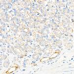 Plectin Antibody in Immunohistochemistry (Paraffin) (IHC (P))