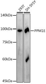 PPM1E Recombinant Rabbit Monoclonal Antibody (2L7W0)