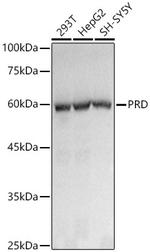 PEPD Recombinant Rabbit Monoclonal Antibody (5C7U8)