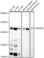 RASSF2 Recombinant Rabbit Monoclonal Antibody (5U1E0)