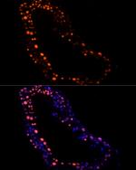 RBMXL2 Antibody in Immunocytochemistry (ICC/IF)