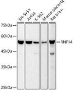 RNF14 Antibody in Western Blot (WB)