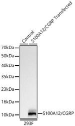 S100A12 Recombinant Rabbit Monoclonal Antibody (4A9D7)