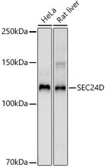 SEC24D Recombinant Rabbit Monoclonal Antibody (6F8S4)