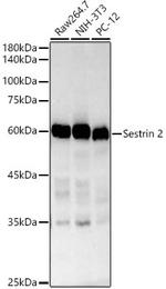 SESN2 Recombinant Rabbit Monoclonal Antibody (8I1W4)