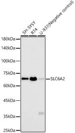 Norepinephrine Transporter Recombinant Rabbit Monoclonal Antibody (6F7V1)