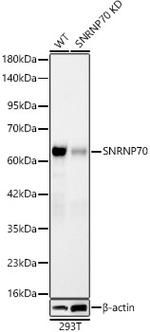 SNRNP70 Recombinant Rabbit Monoclonal Antibody (2W1C8)