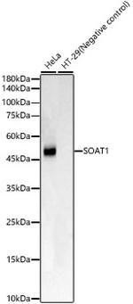 SOAT1 Recombinant Rabbit Monoclonal Antibody (8J8E6)