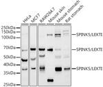SPINK5 Recombinant Rabbit Monoclonal Antibody (9Z2V3)