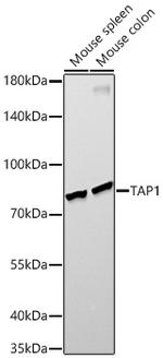TAP1 Recombinant Rabbit Monoclonal Antibody (6Q8Q5)