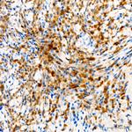 Tyrosinase Antibody in Immunohistochemistry (Paraffin) (IHC (P))