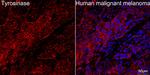 Tyrosinase Recombinant Rabbit Monoclonal Antibody (3O7X10)