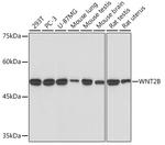 WNT2B Recombinant Rabbit Monoclonal Antibody (9M6O7)