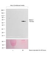 SMOC1 Antibody in Western Blot (WB)