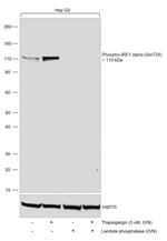 Phospho-IRE1 alpha (Ser724) Antibody