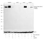 Phospho-ErbB2 (HER-2) (Tyr1248) Antibody