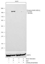 Phospho-ErbB2 (HER-2) (Tyr1248) Antibody
