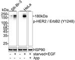 Phospho-ErbB2 (HER-2) (Tyr1248) Antibody in Western Blot (WB)