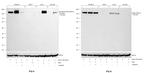Phospho-ErbB2 (HER-2) (Tyr1248) Antibody in Western Blot (WB)