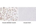 Myosin heavy chain 1 Antibody in Immunohistochemistry (Paraffin) (IHC (P))