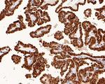 Phospho-ERK1/ERK2 (Thr202, Tyr204, Thr185, Tyr187) Antibody in Immunohistochemistry (Paraffin) (IHC (P))