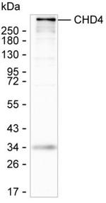CHD4 Recombinant Human Monoclonal Antibody (K49015_15E2)