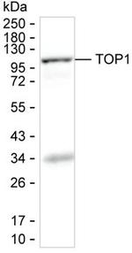 TOP1 Recombinant Human Monoclonal Antibody (K94015_6C5)