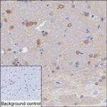 MAPRE2 Monoclonal Antibody (KT52)