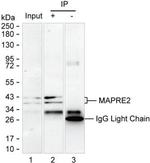 MAPRE2 Antibody in Immunoprecipitation (IP)