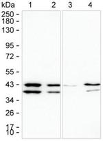 MAPRE2 Antibody in Western Blot (WB)