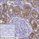 DDAH1 Monoclonal Antibody (K24015_11H12)