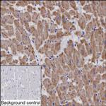 NDUFB8 Monoclonal Antibody (K9N014_11C6)