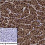 AKR1B1 Monoclonal Antibody (K92029_3F2)