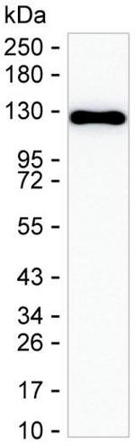 PPP1R9B Monoclonal Antibody (K94019_14H11)