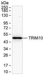 TRIM10 Monoclonal Antibody (K92040_6C6)