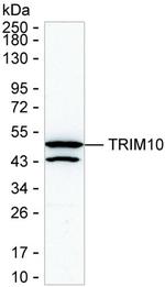 TRIM10 Monoclonal Antibody (K92040_4A6)
