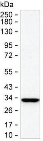 Carbonic Anhydrase VA Monoclonal Antibody (K52035_18D12)