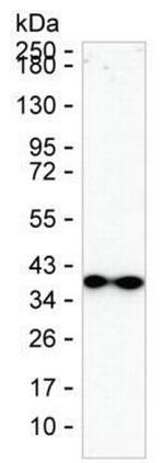Synaptoporin Monoclonal Antibody (K49016_6D3)