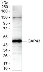 GAP43 Monoclonal Antibody (K29024_1C6)